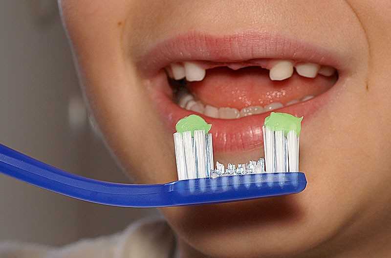 Дополнительные методы ухода за зубами